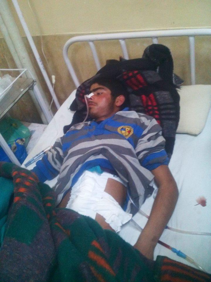 Injured Pulwama boy needs help for treatment